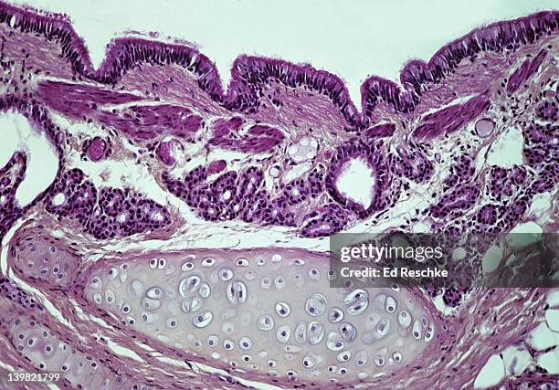 bronchus (wall) in the lung, 50x at 35mm. shows: hyaline cartilage (provides support), glands (mucous secretions), pseudostratified ciliated columnar epithelium, and lumen. - mehrreihige epithel stock-fotos und bilder