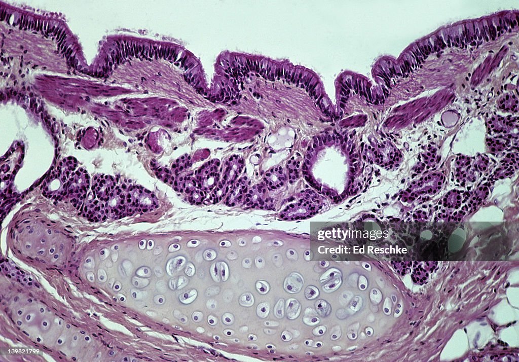 Bronchus (wall) in the lung, 50X at 35mm. Shows: hyaline cartilage (provides support), glands (mucous secretions), pseudostratified ciliated columnar epithelium, and lumen.