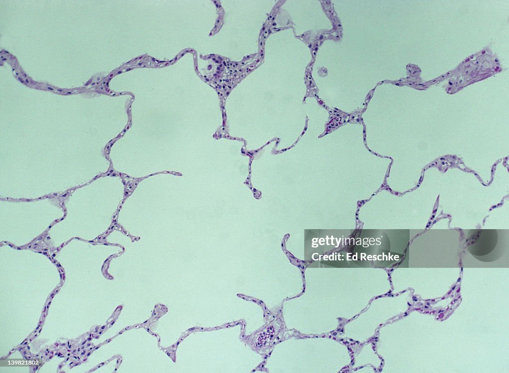 Normal human lung. Alveoli, alveolar (air) sacs, 50X at 35mm. Shows the thin alveolar walls (simple squamous epithelium) adapted for gas exchange. The red structures in the walls are red blood cells in the pulmonary capillaries.