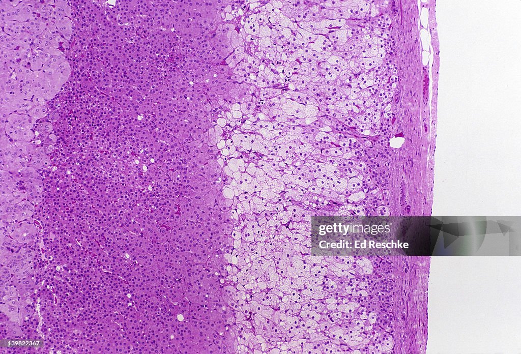 ADRENAL GLAND. CORTEX AND MEDULLA 25X (SI) SIM TO 96646