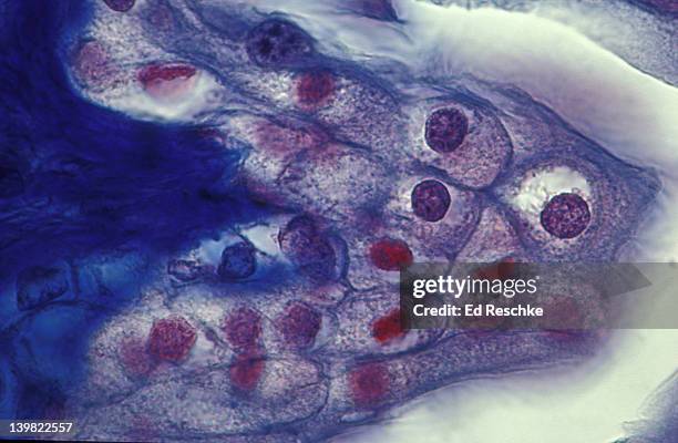 photomicrograph of urinary bladder showing rather plump cells of the transitional epithelium in their relaxed state; 250x - transitional epithelium stock pictures, royalty-free photos & images