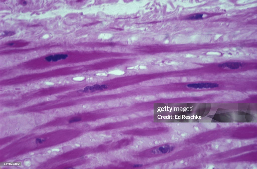 Photomicrograph of blood vessels in smooth muscle; longitudinal section; 250X