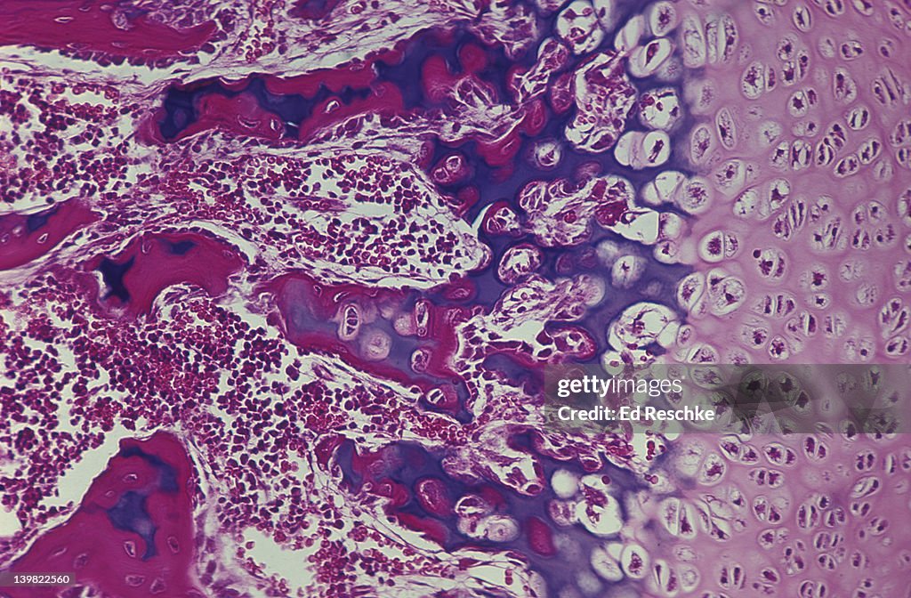 Photomicrograph of endochondral ossification of developing bone in phalanx, of a monkey, showing calcified cartilage; 50X.
