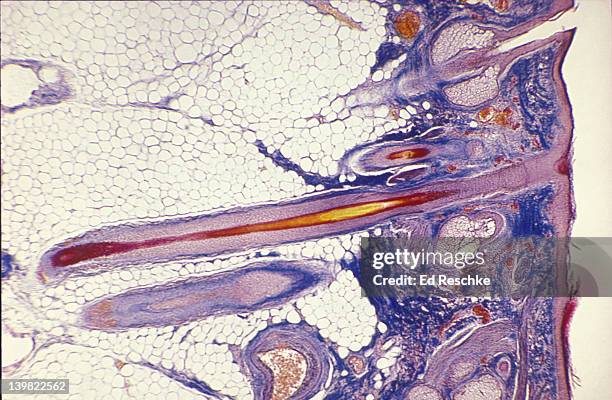 photomicrograph of human scalp showing epidermis, dermis, subcutaneous layer, hair shaft, hair follicles, adipose tissue, blood vessels and sebaceous glands; 10x. - human hair microscope stock pictures, royalty-free photos & images