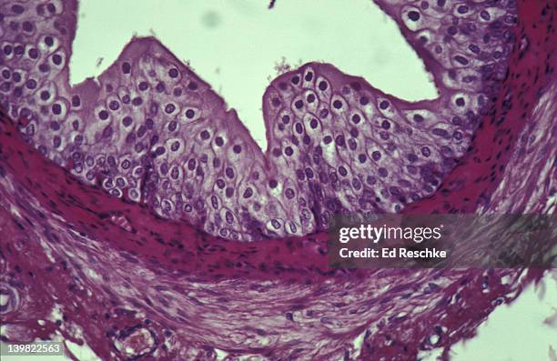 photomicrograph of transitional epithelium of human ureter; 400x - transitional epithelium stock pictures, royalty-free photos & images