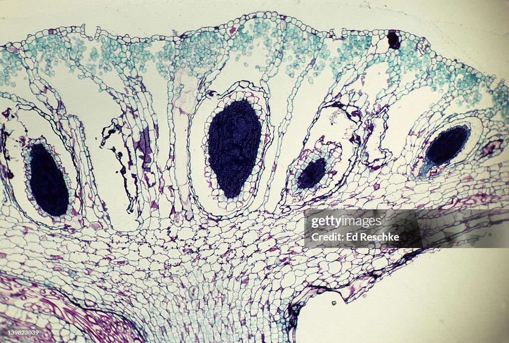 ANTHERIDIA. ANTHERIDIAL HEAD. MALE, GAMETOPHYTE. MARCHANTIA. 25X