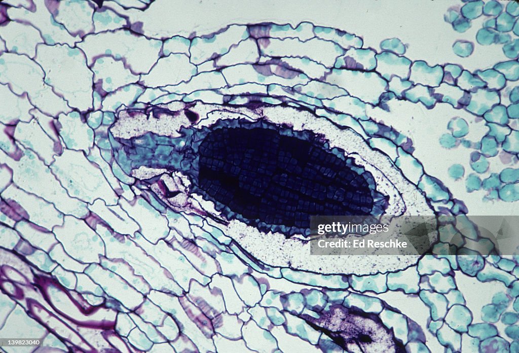 ANTHERIDIUM AND SPERM (DARK AREA). BRYOPHYTA. MARCHANTIA (LIVERWORT). 100X