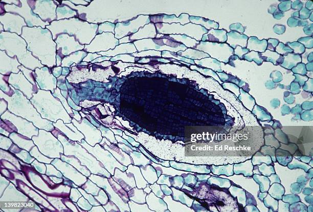 antheridium and sperm (dark area). bryophyta. marchantia (liverwort). 100x - prothallium stock pictures, royalty-free photos & images