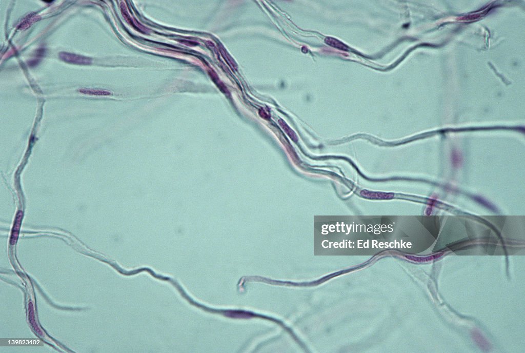 SMOOTH MUSCLE. TEASED, SMALL INTESTINE, 100X Shows: nuclei, cytoplasm and tapered muscle fibers (or cells). Nonstriated, involuntary muscle.