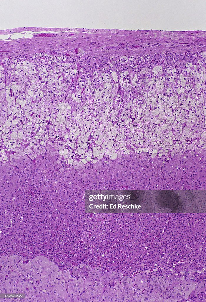 ADRENAL GLAND. CORTEX & MEDULLA, 25X Shows: cortex, capsule, zona glomerulosa, zona fasciculata, zona reticularis & medulla.