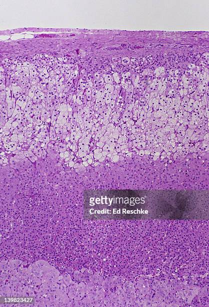 adrenal gland. cortex & medulla, 25x shows: cortex, capsule, zona glomerulosa, zona fasciculata, zona reticularis & medulla. - fasciculata stock pictures, royalty-free photos & images