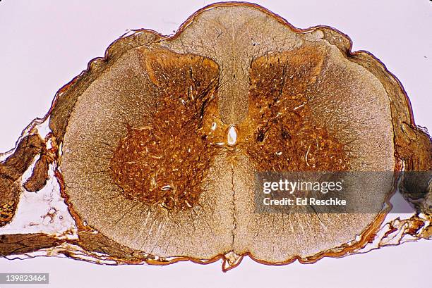 spinal cord cross section, 5x shows: gray matter (golden butterfly), white matter, central canal, dorsal & ventral root, dorsal root ganglion, meninges, dorsal horn, ventral (anterior) horn, & anterior horn cells (motor neuron cell bodies) - spinal neuron imagens e fotografias de stock