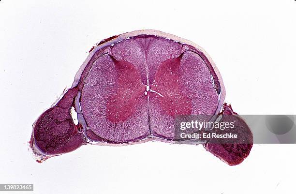 spinal cord. cross section, 2.5x. shows: gray matter, white matter, dorsal root ganglia, dorsal and ventral roots, central canal, anterior horn cells (motor neuron cell bodies) & meninges - spinal neuron imagens e fotografias de stock