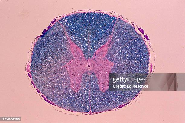 spinal cord. cross section, 5x shows: gray matter (inner pink, butterfly-shaped area), white matter (outer blue area), central canal, meninges, dorsal horn, lateral horn, ventral (anterior) horn, and anterior horn cells (motor neuron cell bodies). - spinal neuron imagens e fotografias de stock
