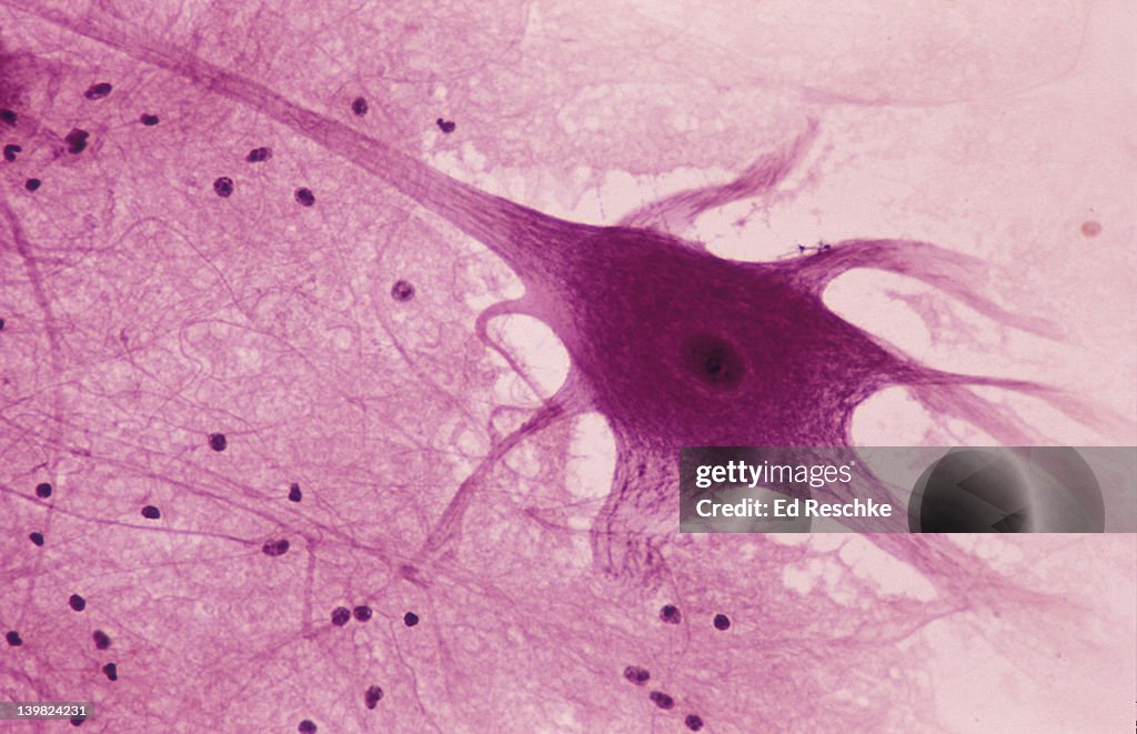 Photomicrograph of motor neuron of spinal cord, showing cell body, nucleus, dendrites, axon, and neurolglia (black spots); 50X.