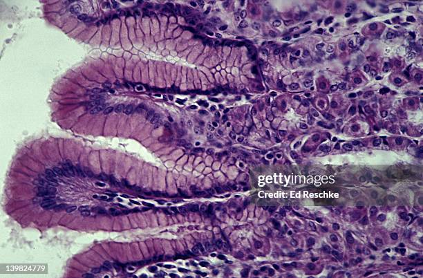 fundic stomach, human gastric glands. 400x h - human gland stockfoto's en -beelden