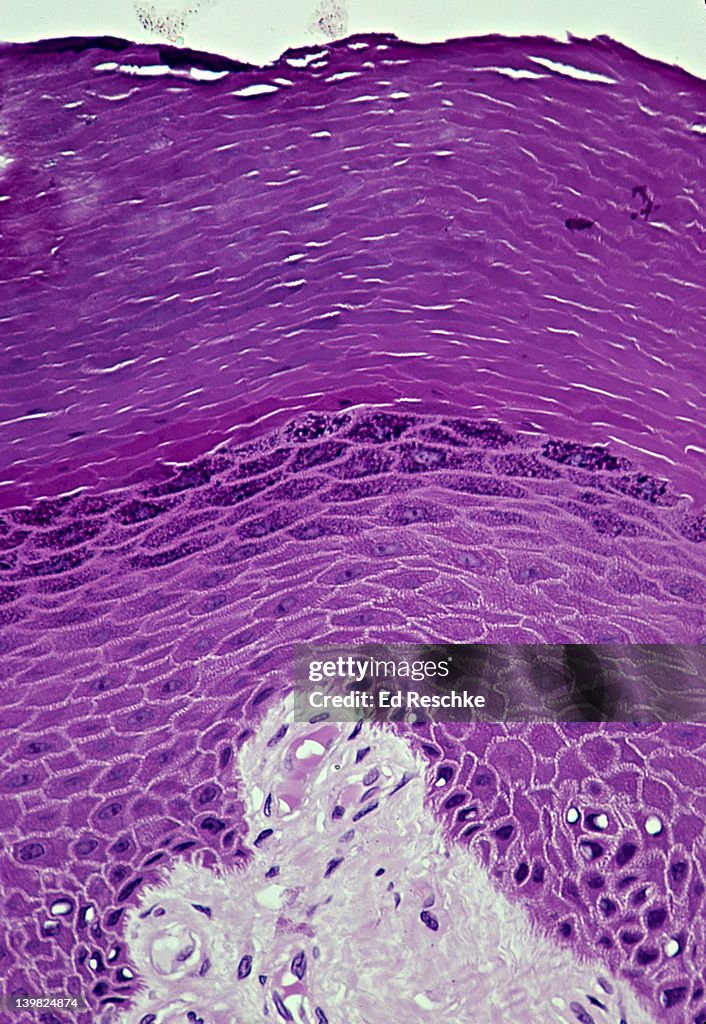 STRATIFIED SQUAMOUS EPITHELIUM Epidermis (Keratinized, Thick Skin, Human, 100x). Shows layers in epidermis: stratum corneum, stratum granulosum, stratum spinosum & stratum basale (basal layer of epidermis). Also, shows dermis (lighter) below.