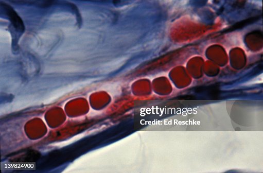 Capillary Rbc Microscope Capillary And Red Blood Cells 500x H High-Res Stock Photo - Getty Images