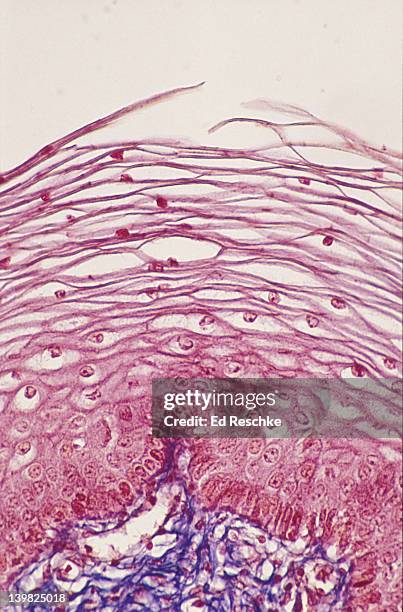 photomicrograph of stratified squamous epithelium of the vagina showing desquamation of epithelial cells; note flattening of cells near surface; mallory stain, 100x. - epitelio squamoso stratificato foto e immagini stock