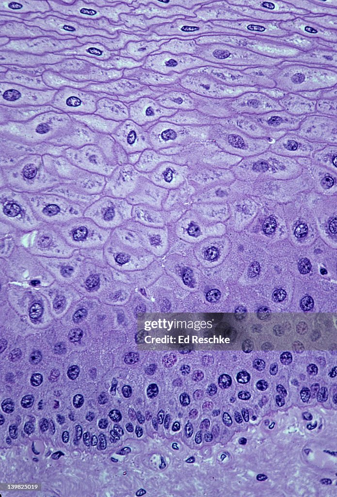 STRATIFIED SQUAMOUS EPITHELIUM (Esophagus, non-keratinized, 100x at 35mm) This epithelium has many layers ( or strata) and the cells near the surface become very flat (squamous). Also, shows supporting connective tissue below.