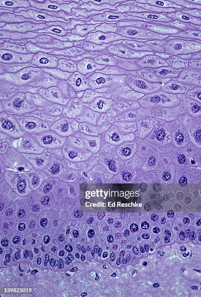 stratified squamous epithelium (esophagus, non-keratinized, 100x at 35mm) this epithelium has many layers ( or strata) and the cells near the surface become very flat (squamous). also, shows supporting connective tissue below. - keratinized stock pictures, royalty-free photos & images