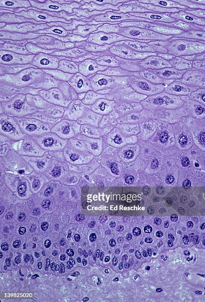 stratified squamous epithelium (esophagus, non-keratinized, 100x) this epithelium has many layers ( or strata) and the cells near the surface become very flat (squamous). also, shows supporting connective tissue below. - epitélio escamoso imagens e fotografias de stock