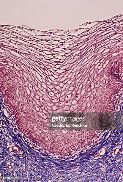stratified squamous epithelium (vagina, non-keratinized) 50x this epithelium has many layers (or strata) and the cells near the surface become very flat (squamous). also, shows supporting connective tissue below. - stratified squamous epithelium stock pictures, royalty-free photos & images