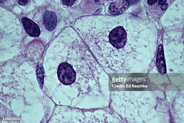 liver cells, eukaryotic cell, 250x. shows: nucleus, cytoplasm, plasma membrane. amphiuma (salamander, siren) - sangue umano foto e immagini stock
