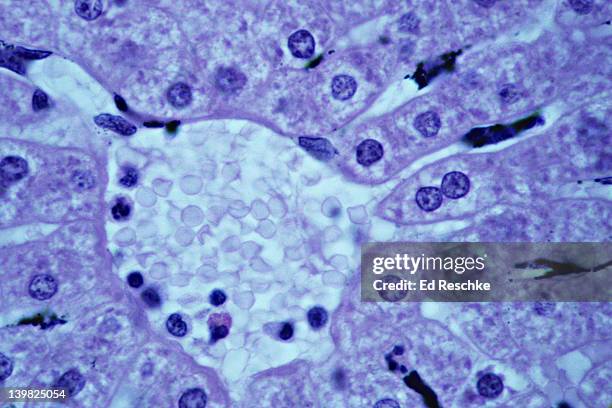 liver. kupffer (phagocytic cells) and histology, 250x. shows: central vein, sinusoids, hepatic cells (some binucleate), dark areas in the sinusoids are phagocytic (kupffer) cells. - enzym stock-fotos und bilder