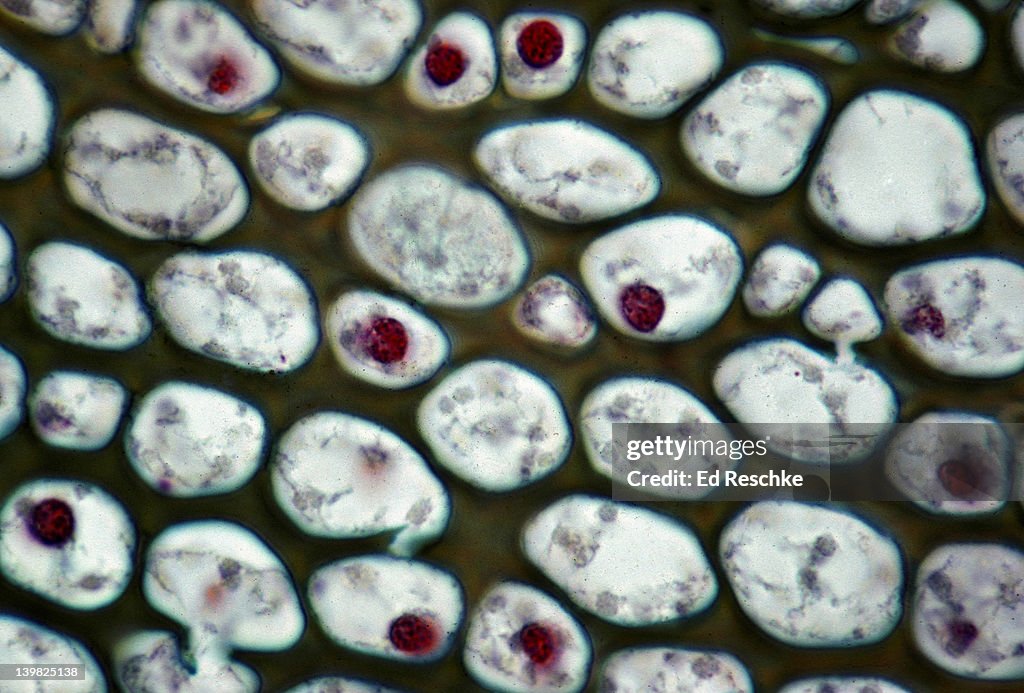 COLLENCHYMA (PLANT TISSUE). SUPPORTING TISSUE. SAMBUCUS (ELDERBERRY) STEM. CELLS HAVE NUCLEI. H