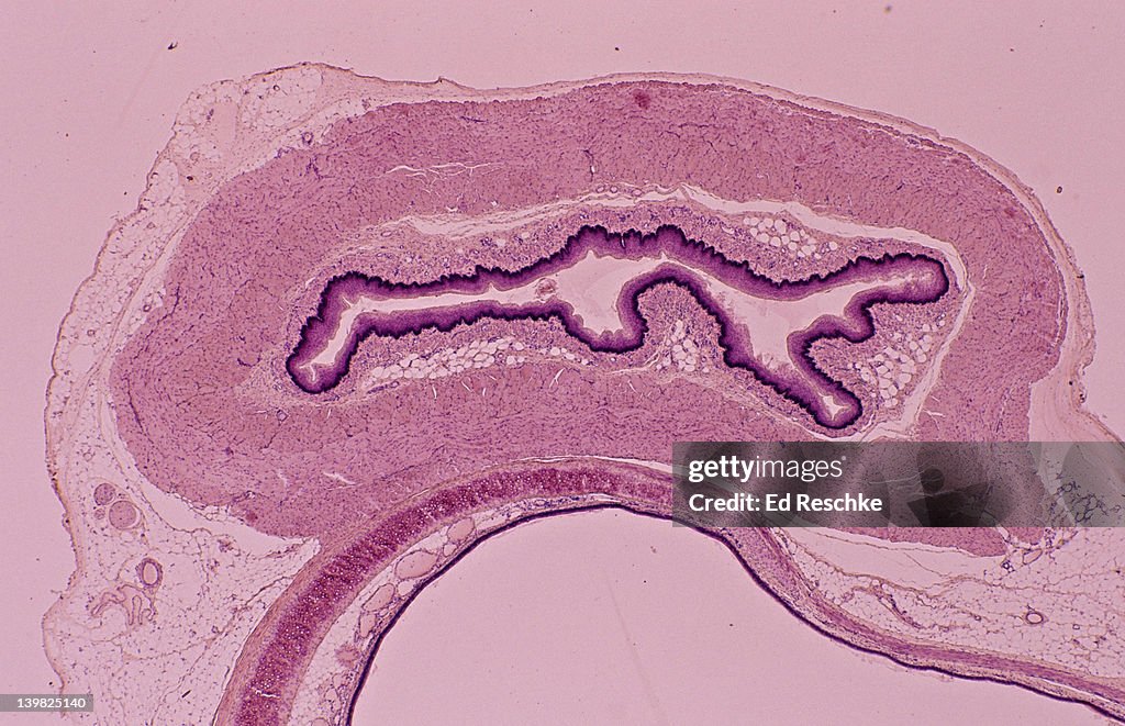 ESOPHAGUS & PART OF THE TRACHEA, CROSS SECTION, 5X. Shows: lumen, mucosa, submucosa, muscularis (smooth muscle), adventitia. Trachea: hyaline cartilage, mucous membrane.