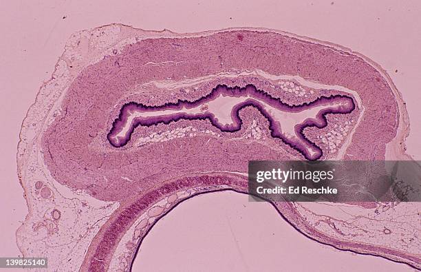 esophagus & part of the trachea, cross section, 5x. shows: lumen, mucosa, submucosa, muscularis (smooth muscle), adventitia. trachea: hyaline cartilage, mucous membrane. - oesophagus stock pictures, royalty-free photos & images