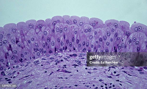 transitional epithelium, bladder, 100x shows: many cell layers, cells near the surface that are larger and pear-shaped, basement membrane and supporting connective tissue below. unstretched state. - transitional epithelium stock pictures, royalty-free photos & images