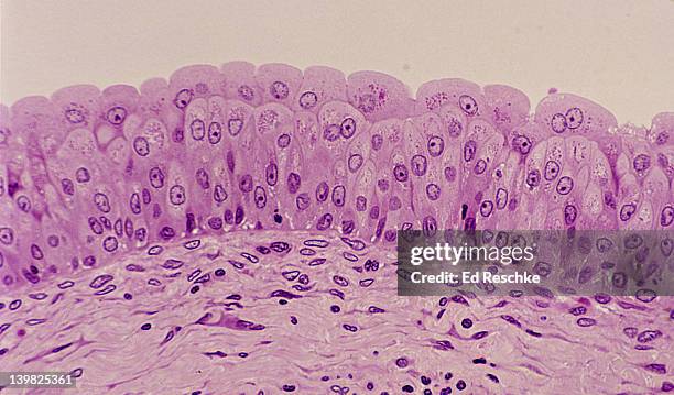 transitional epithelium, bladder, 250x shows: many layers of cells, cells near the surface that are larger and pear-shaped, basement membrane, and supporting connective tissue below. - transitional epithelium stock pictures, royalty-free photos & images