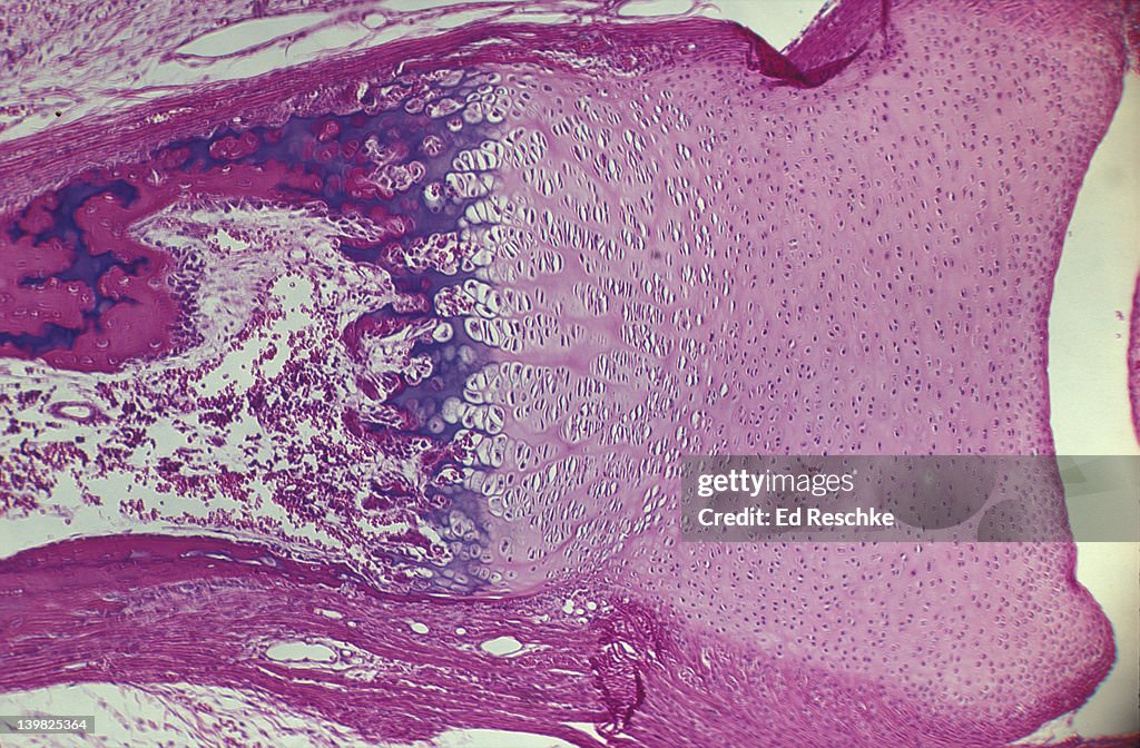 Photomicrograph of endochondral ossification of developing bone in phalanx showing epiphyseal disk, hyaline cartilage, calcified cartilage and osteocytes.