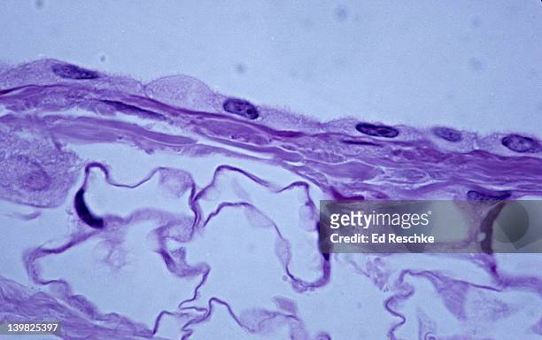 simple squamous epithelium (mesothelium), side or profile view, 250x. shows: the flatness of the squamous cells, nuclei, cytoplasm and cell membrane. found in the human omentum - epitelio squamoso foto e immagini stock
