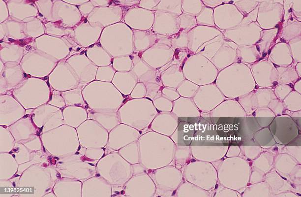 adipose tissue. fat cells. adipocytes nucleus and cytoplasm pushed to periphery, connective tissue. 100x h - fettgewebezelle stock-fotos und bilder