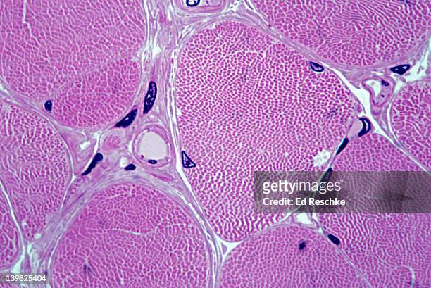 skeletal muscle fibers. cross section. shows peripheral nuclei and myofibrils. 1000x h - muskelfaser stock-fotos und bilder