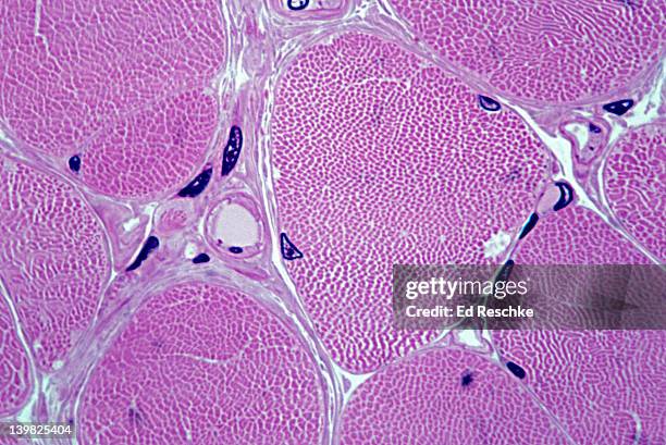 skeletal muscle fibers. cross section. shows peripheral nuclei and myofibrils. 1000x h - muscle cell stock pictures, royalty-free photos & images