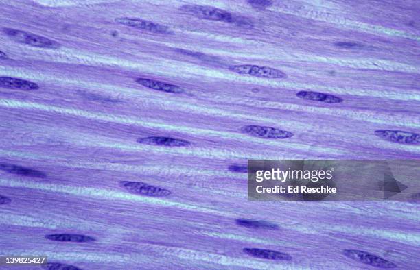 smooth muscle. large intestine, 250x at 35mm. shows: cytoplasm and nuclei. nonstriated muscle tissue, involuntary. - muskelfaser stock-fotos und bilder