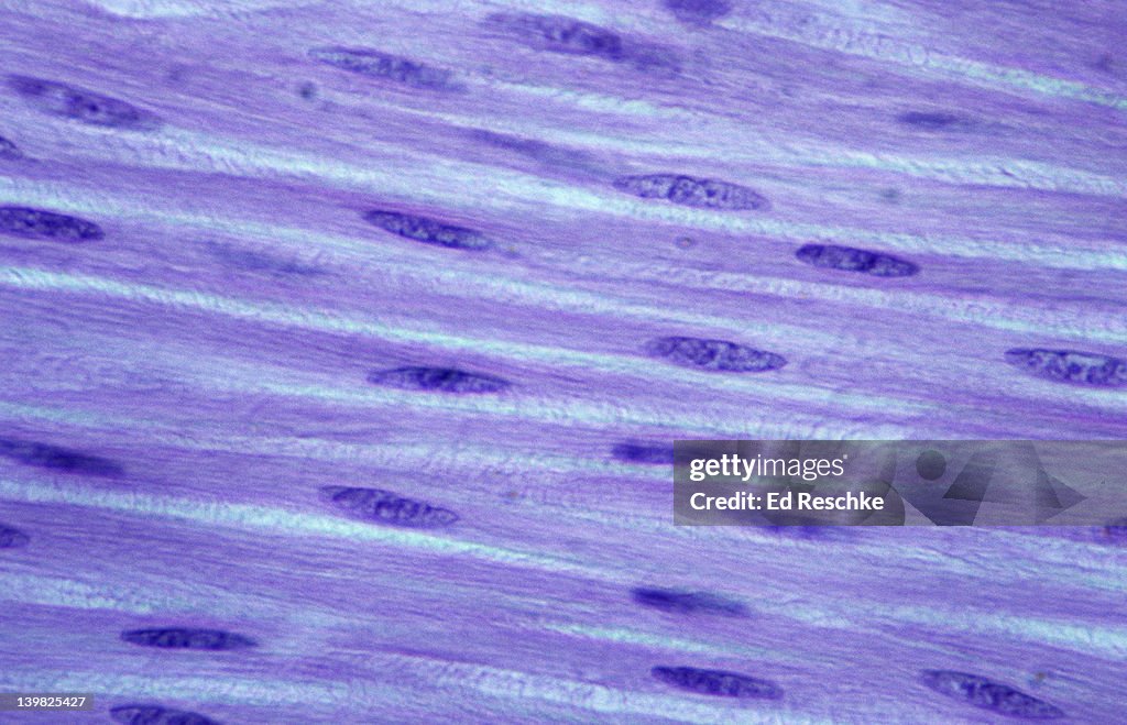 SMOOTH MUSCLE. Large Intestine, 250X at 35mm. Shows: cytoplasm and nuclei. Nonstriated muscle tissue, involuntary.