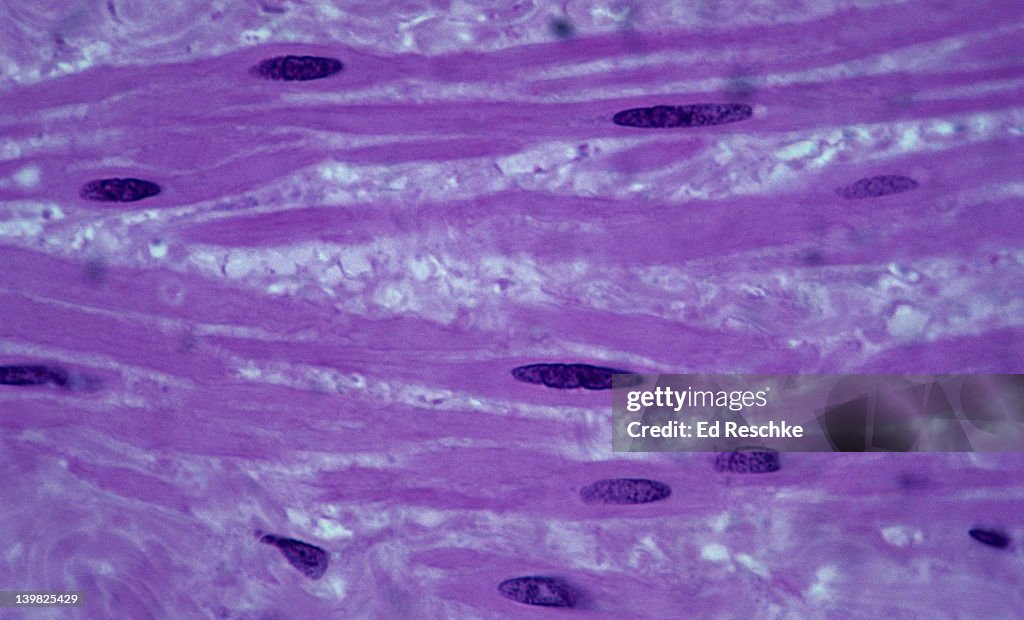 SMOOTH MUSCLE. Blood Vessel Wall, 250X Shows: tapered cells with nuclei, cytoplasm, and nonstriated nature. Vascular smooth muscle. Functions in vasoconstriction and vasodilatation. Involuntary muscle.