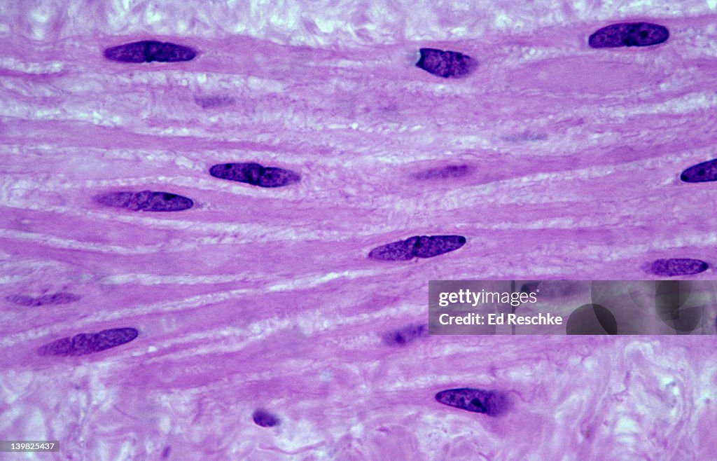 SMOOTH MUSCLE. Blood Vessel Wall, 250X Shows: tapered cells with nuclei, cytoplasm, and nonstriated nature. Vascular smooth muscle. Functions in vasoconstriction and vasodilatation. Involuntary muscle.