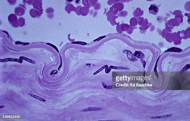 simple squamous epithelium. endothelium (lining an artery) 250x. this epithelium lines the inside of blood vessels. it is extrememly flat, note flattened nuclei. also shows internal elastic membrane & smooth muscle in artery wall. - simple squamous epithelium stock-fotos und bilder