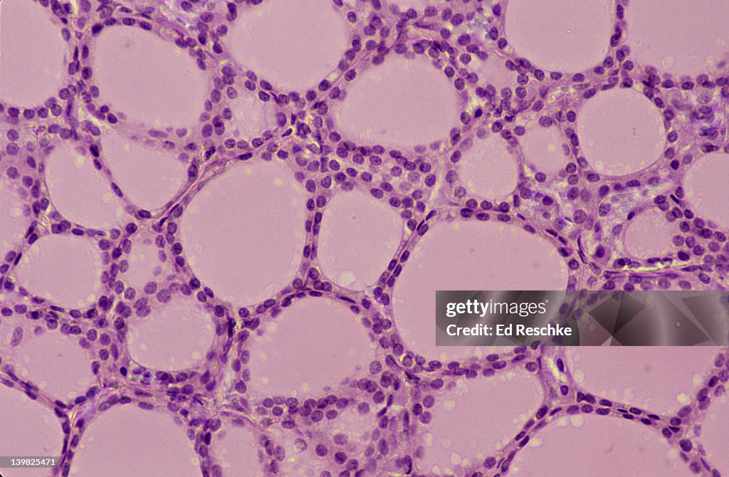 THYROID GLAND. 100X Shows: follicles, colloid, and simple cuboidal epithelium. Human.