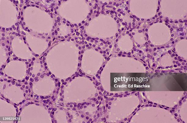 thyroid gland. 100x shows: follicles, colloid, and simple cuboidal epithelium. human. - epitelio imagens e fotografias de stock