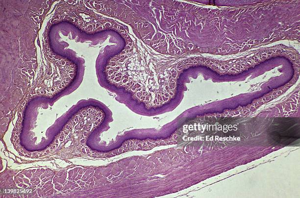 Muscularis Mucosae StockFotos und Bilder Getty Images