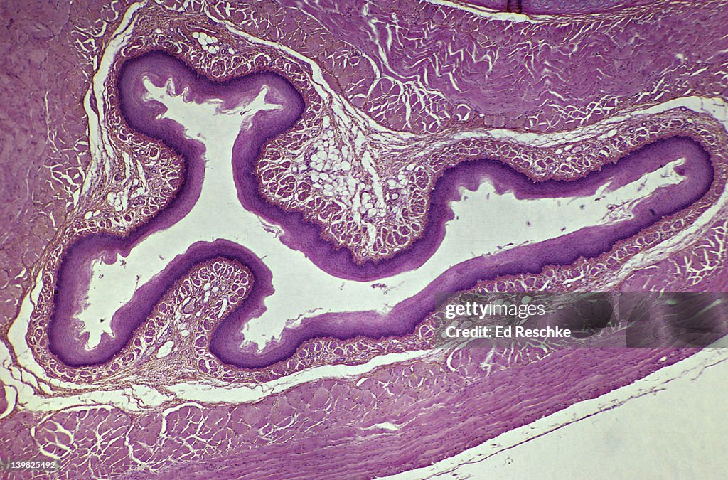 ESOPHAGUS, CROSS SECTION, 10X. Shows: mucosa, submucosa, muscularis, adventitia and lumen.