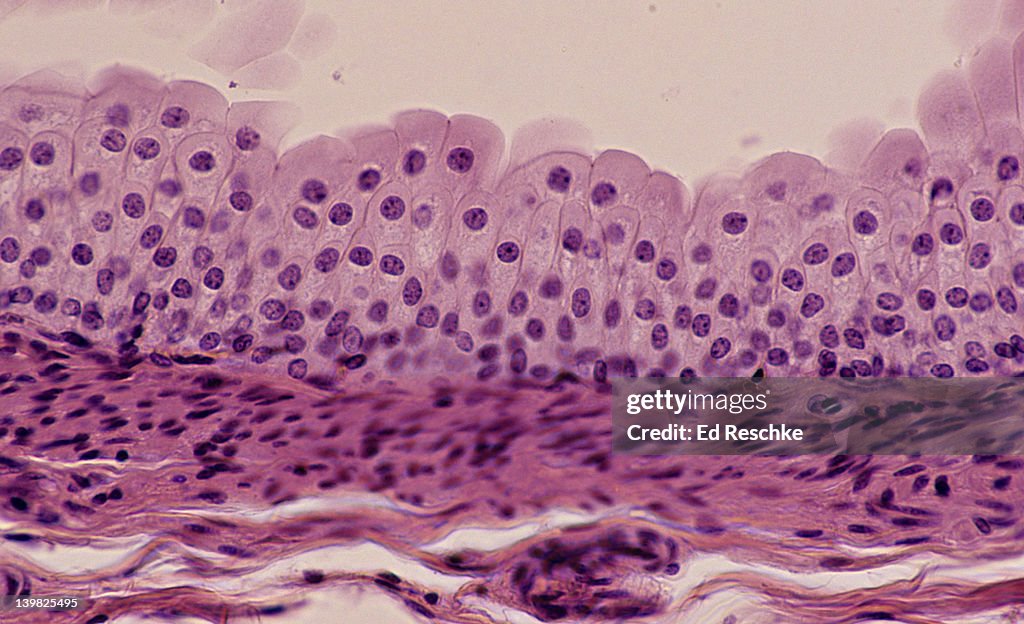 TRANSITIONAL EPITHELIUM, URETER, 100X Shows: many cell layers, cells near the surface that are pear-shaped, supporting connective below. Unstretched state. Also, found in the bladder.