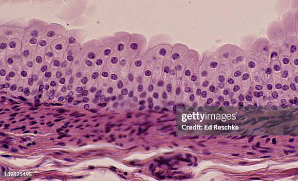 transitional epithelium, ureter, 100x shows: many cell layers, cells near the surface that are pear-shaped, supporting connective below. unstretched state. also, found in the bladder. - urothelium stock pictures, royalty-free photos & images